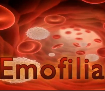 Emofilia